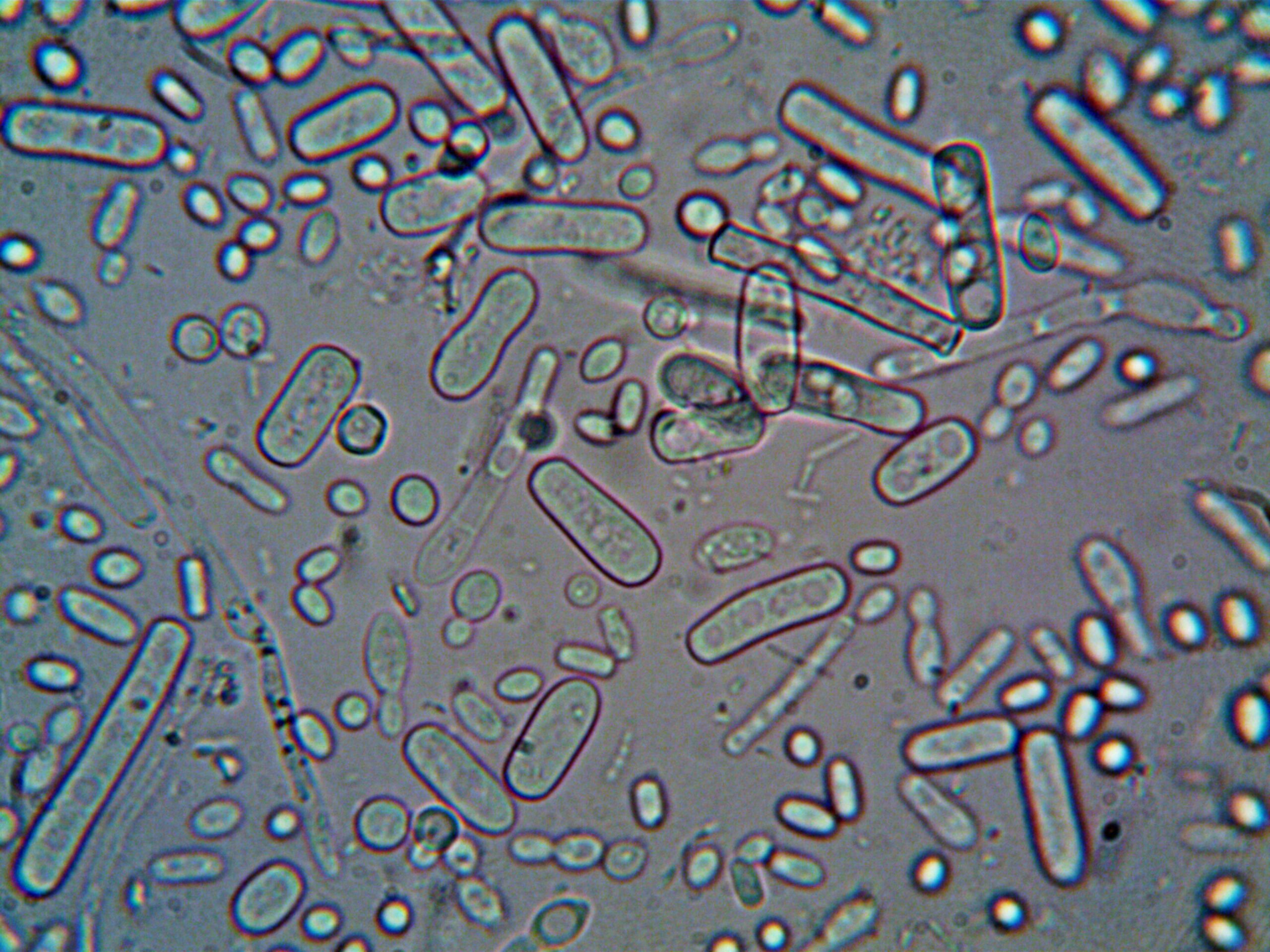 Wat moet je doen als je een vleesetende bacterie hebt?